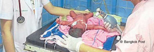 Bangkok - Bambina trovata in un sacchetto